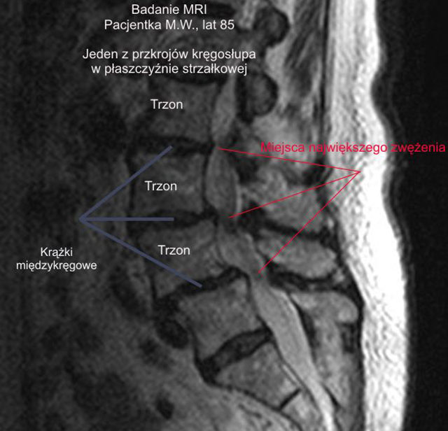 Mri640 4887